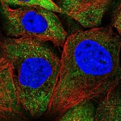 SEPN1 Antibody, Novus Biologicals 0.1mL; Unlabeled:Antibodies, Polyclonal